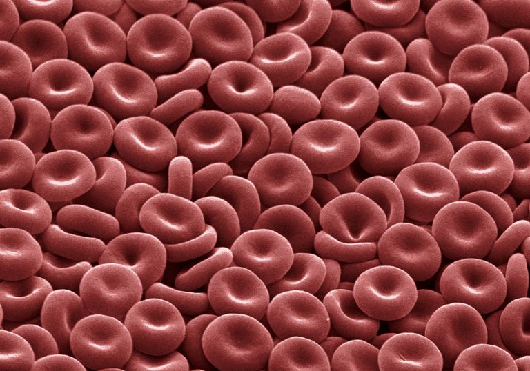 Cáncer de la sangre y anemia