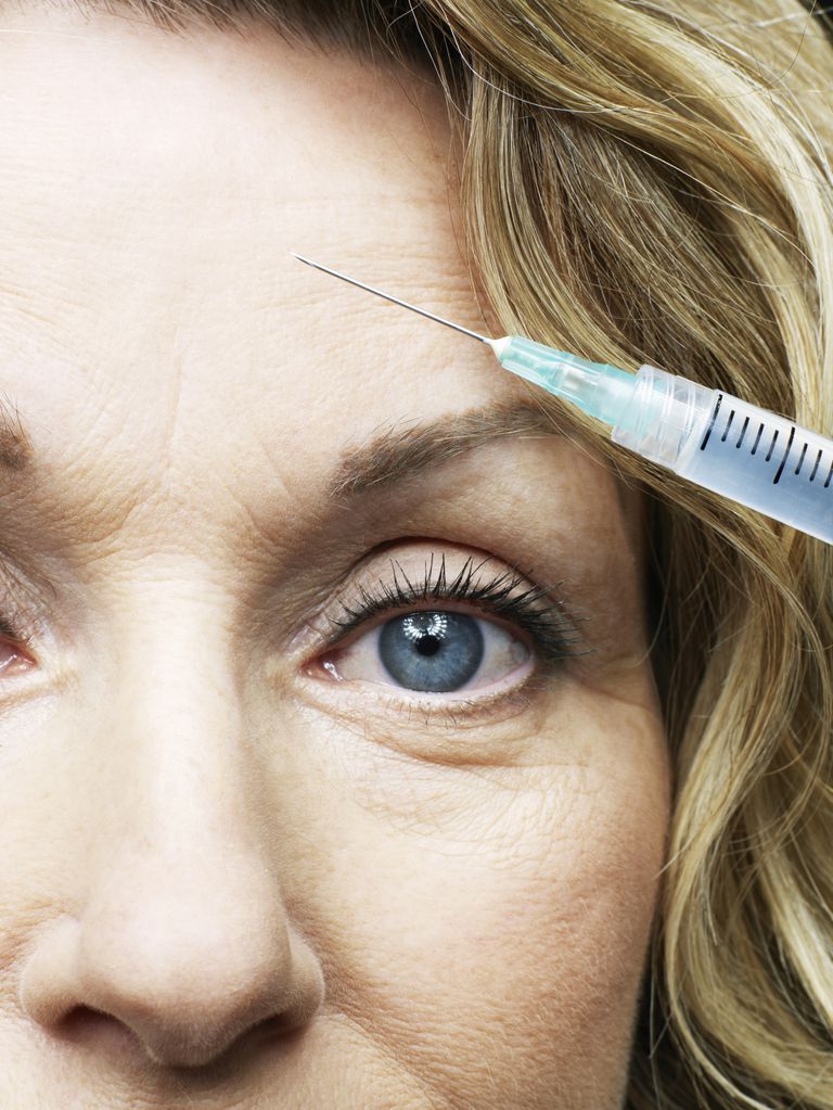 Resistencia al Botox: cuando no funciona