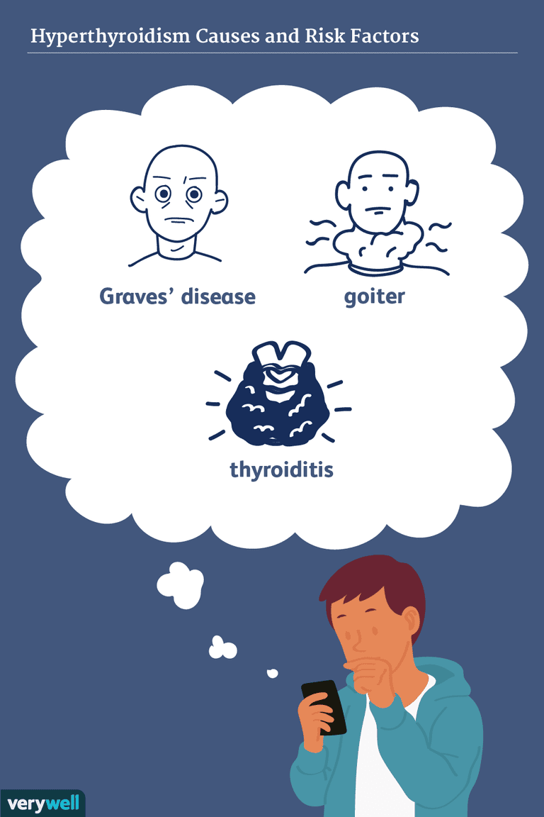 Causas y factores de riesgo del hipertiroidismo