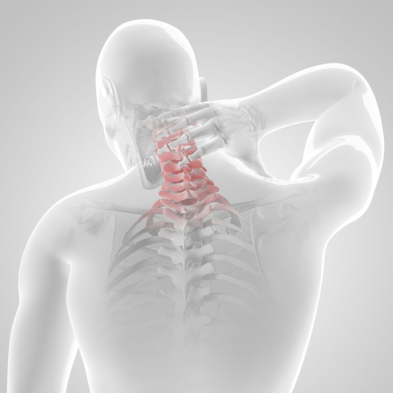 Dolor de espalda y cuello Replace Reemplazo del disco cervical