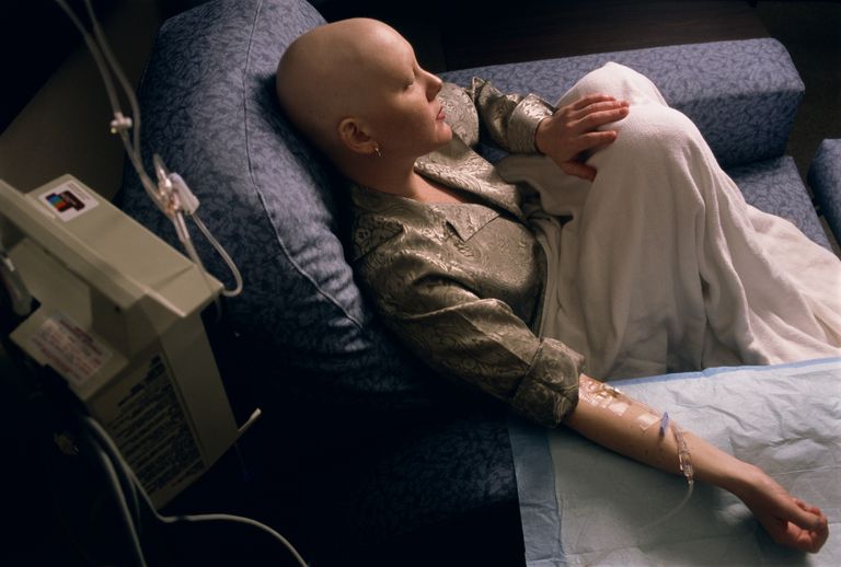 Quimioterapia para el cáncer de colon