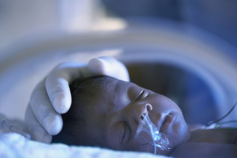 Enfermedad pulmonar crónica (EPC) en bebés prematuros