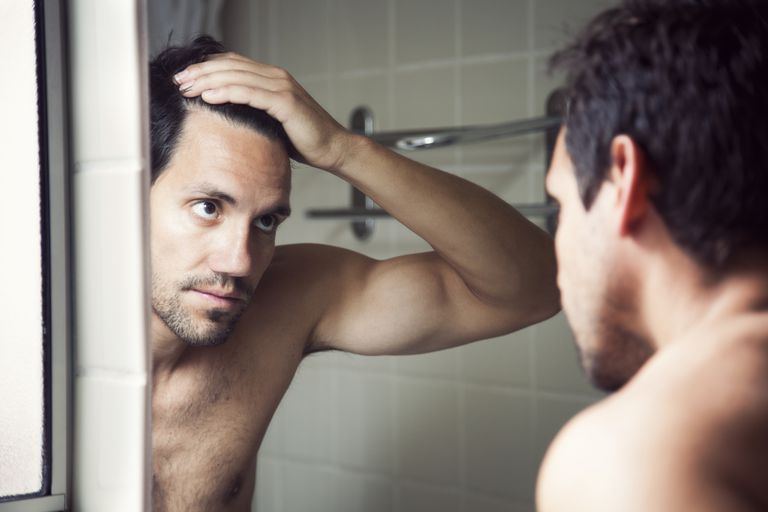 Causas comunes de pérdida excesiva de cabello en hombres