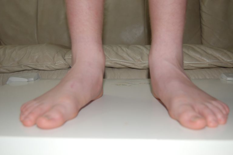 Problemas pediátricos comunes del pie