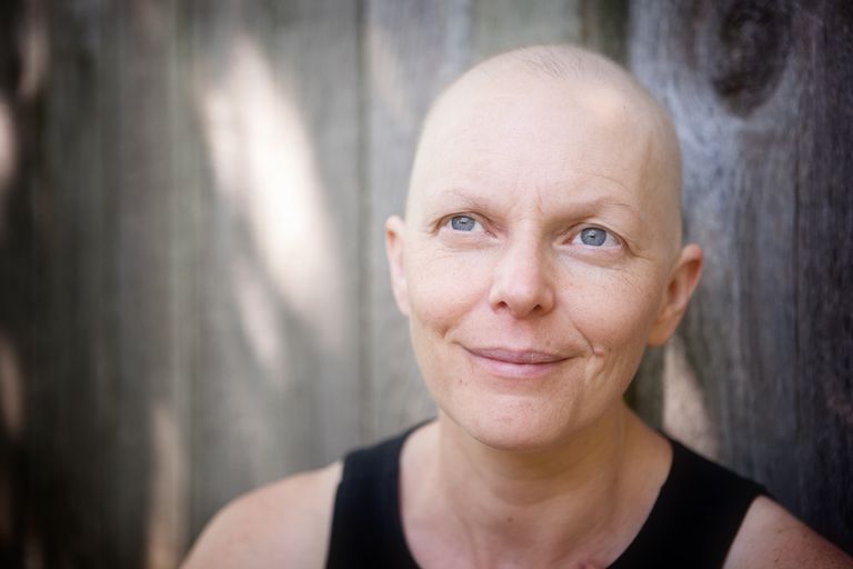 Hacer frente a la pérdida de cabello durante la quimioterapia