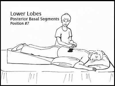 Cómo realizar el drenaje postural para personas con EPOC