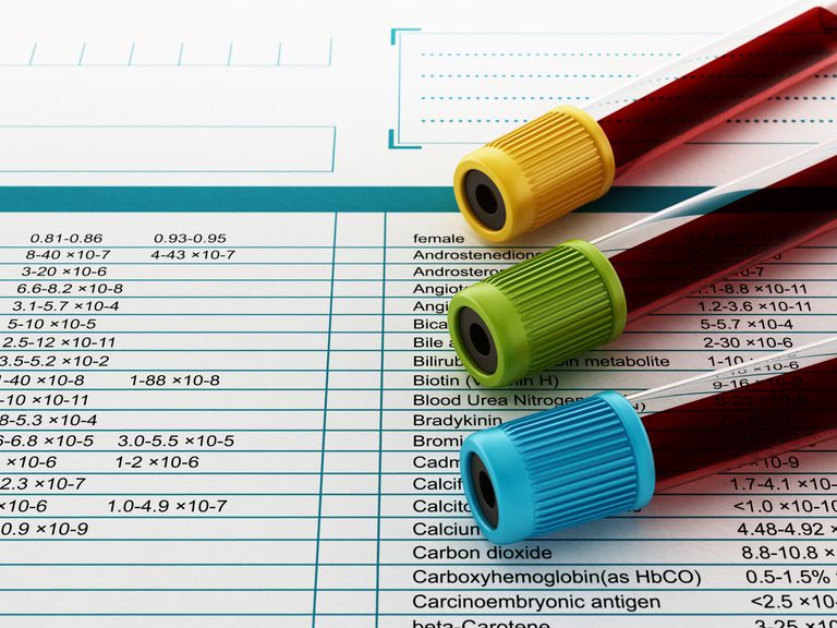 Descifrar las pruebas de sangre de rutina del VIH
