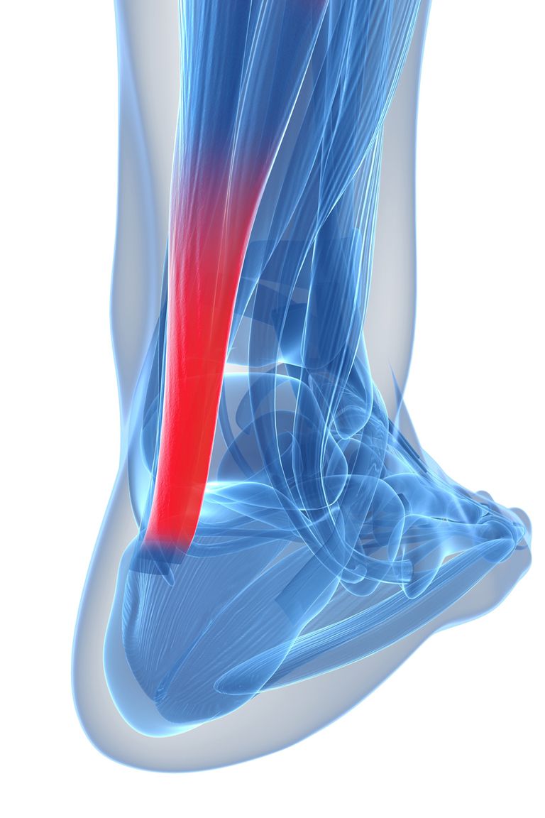 Definición del tendón de Aquiles: información y prevención de lesiones