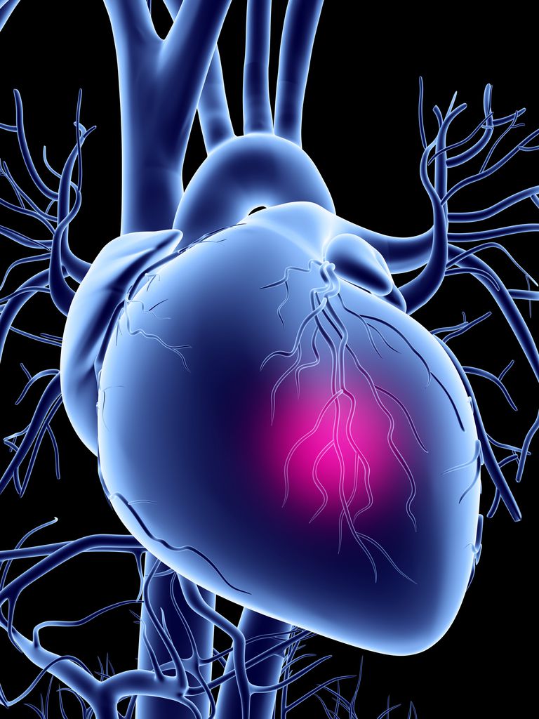 Diagnóstico de la enfermedad de la arteria coronaria