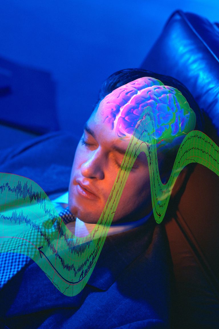 Diagnóstico de narcolepsia: prueba de latencia múltiple del sueño