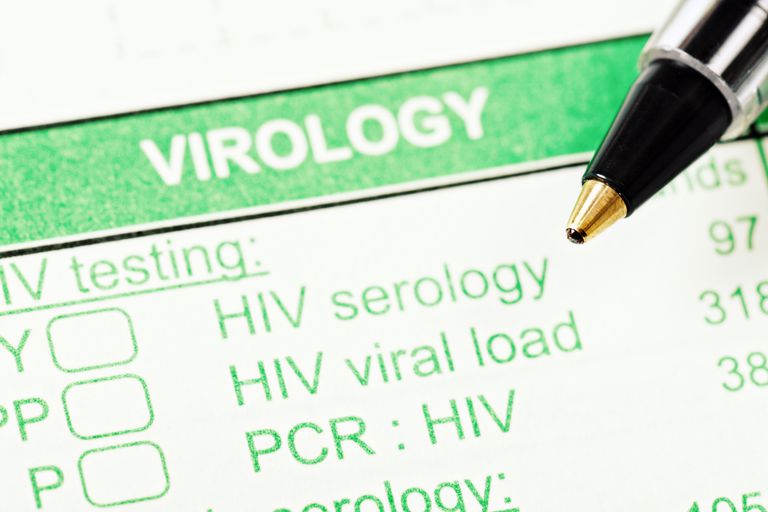 Distinguir entre nuevas infecciones por VIH y personas de edad