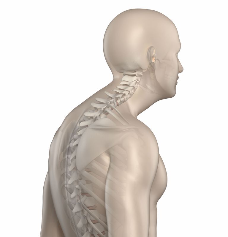 Dolor de espalda y cuello k La cifosis dorsal es un término técnico para un fenómeno muy común, que es el de una postura redondeada de la espalda superior. El término del argot para este fenómeno es un jorobado. Los músculos débiles o sobreestirados en el área torácica superior explican muchos casos de cifosis dorsal.