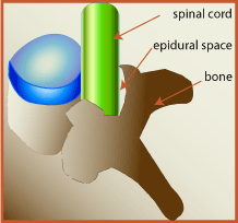 Espacio epidural