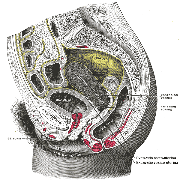 Fluido en el canal posterior anterior o posterior