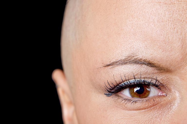 Rebrote del cabello después de la quimioterapia