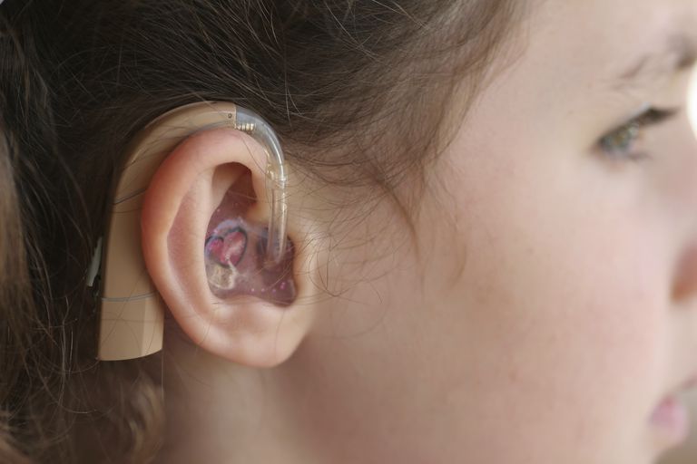 Pérdida de audición y niños: principales causas de sordera en niños