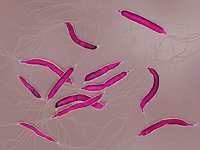 Infección por Helicobacter Pylori y migrañas