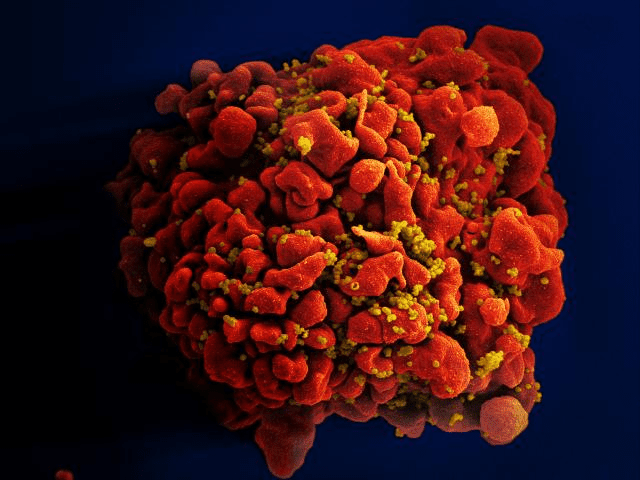 VIH y SIDA: una descripción general