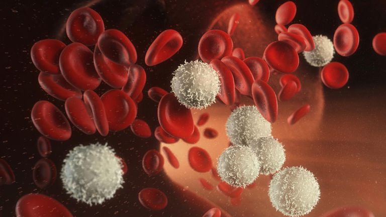 VIH y su conteo sanguíneo completo (CBC)