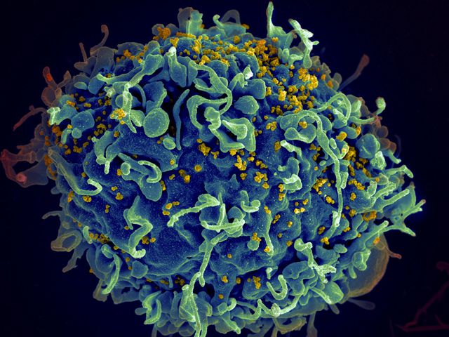 Microscopio de VIH en imágenes