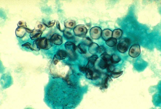 Microscopio de VIH en imágenes