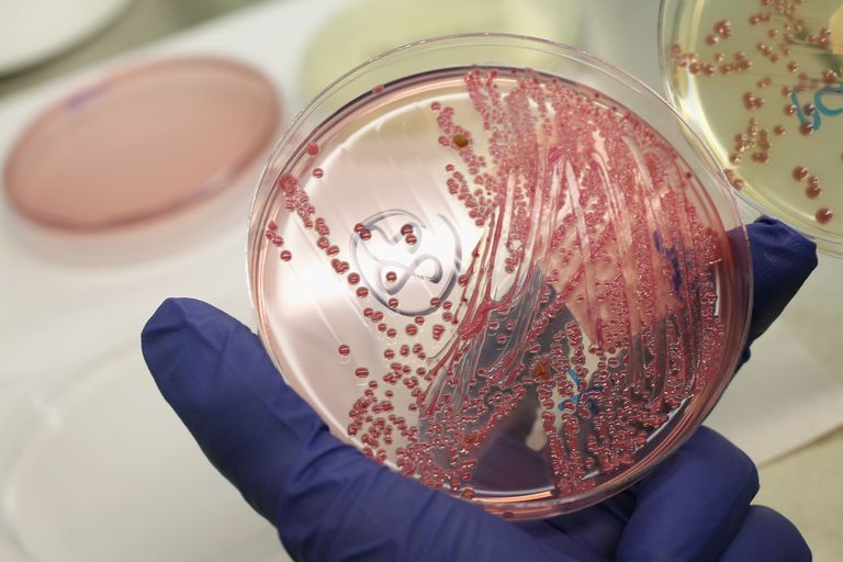 ¿Cómo los microbios enferman a las personas con hepatitis?