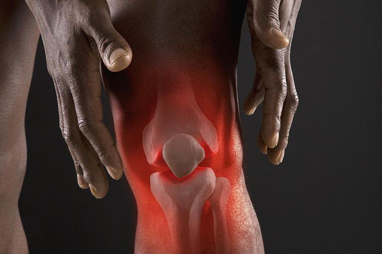 ¿Cómo se usa Hyalgan para tratar la osteoartritis de la rodilla?