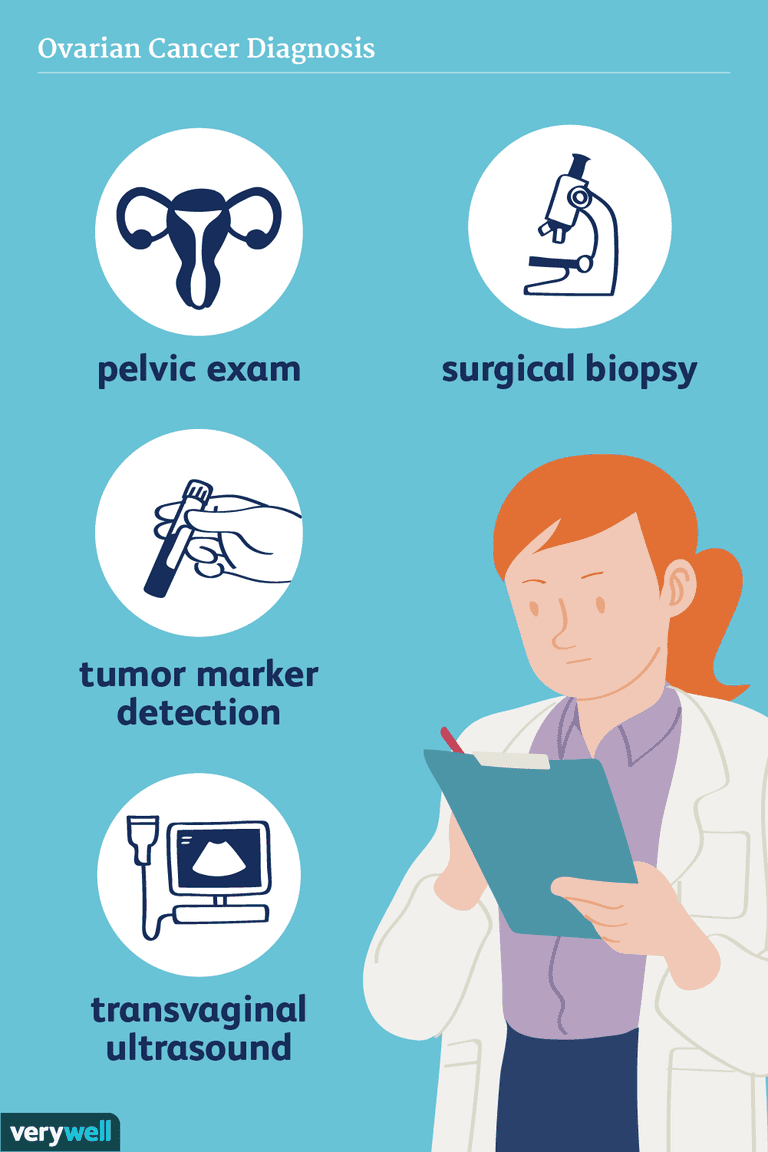 Cómo se diagnostica el cáncer de ovario