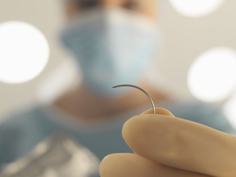 Cómo cuidar las suturas insolubles