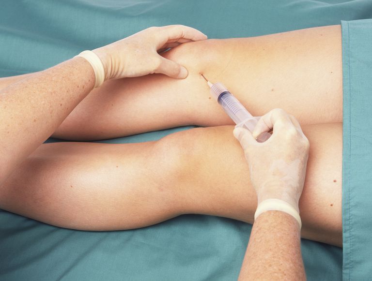 Cómo realizar una inyección en la rodilla