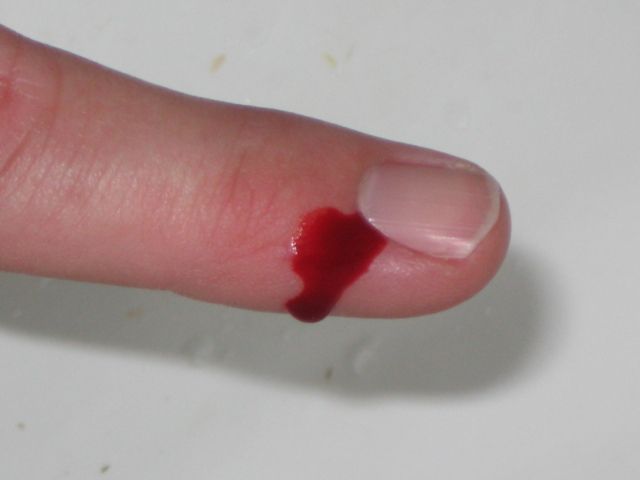 Cómo tratar un corte en su dedo