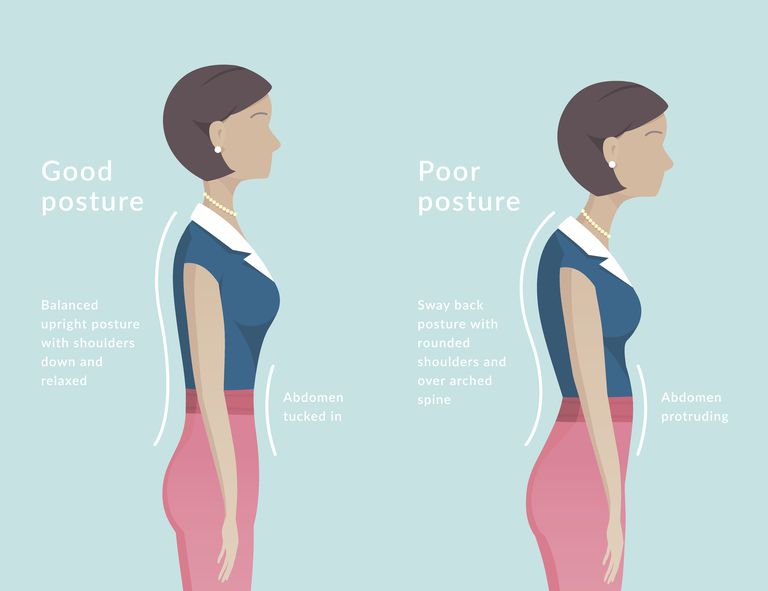 La postura ideal y la buena alineación corporal pueden ayudar a aliviar el dolor de espalda