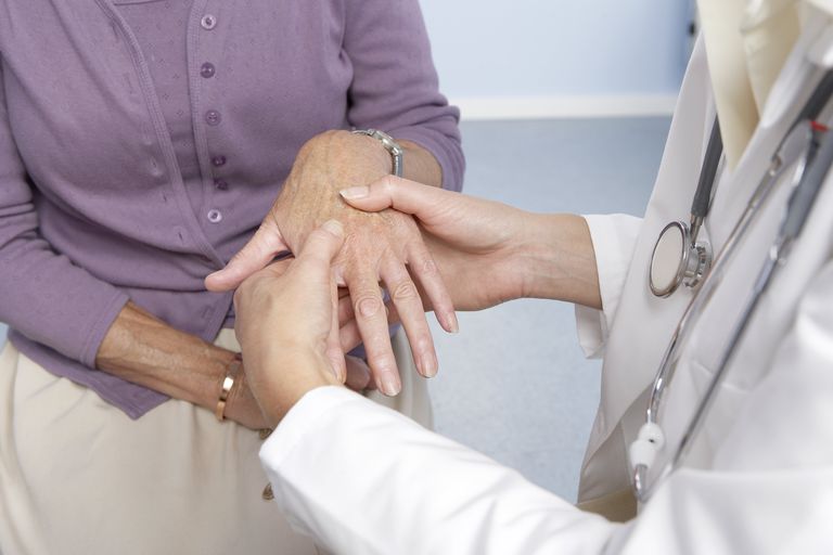Mayor riesgo de linfoma en pacientes con artritis reumatoide
