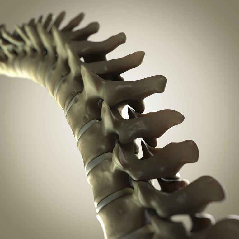 Dolor de espalda y cuello Joint Definición de articulación intervertebral