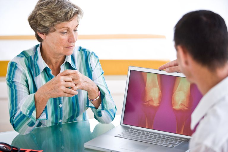 ¿Está asociada la osteoartritis con un mayor riesgo de mortalidad?