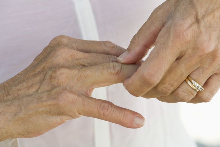 Agrietamiento y agrietamiento de las articulaciones: ¿es un problema? Artritis
