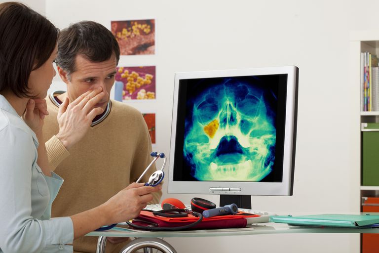 Oído, nariz y garganta An Antrostomía maxilar