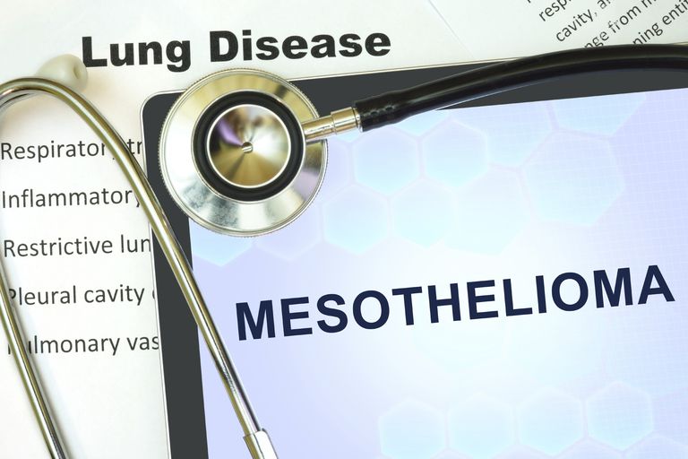 Mesotelioma: síntomas, causas, tratamientos y pronóstico