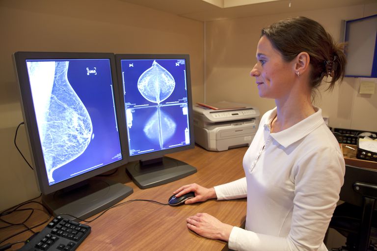 Métodos y pruebas usados ​​para diagnosticar el cáncer de seno