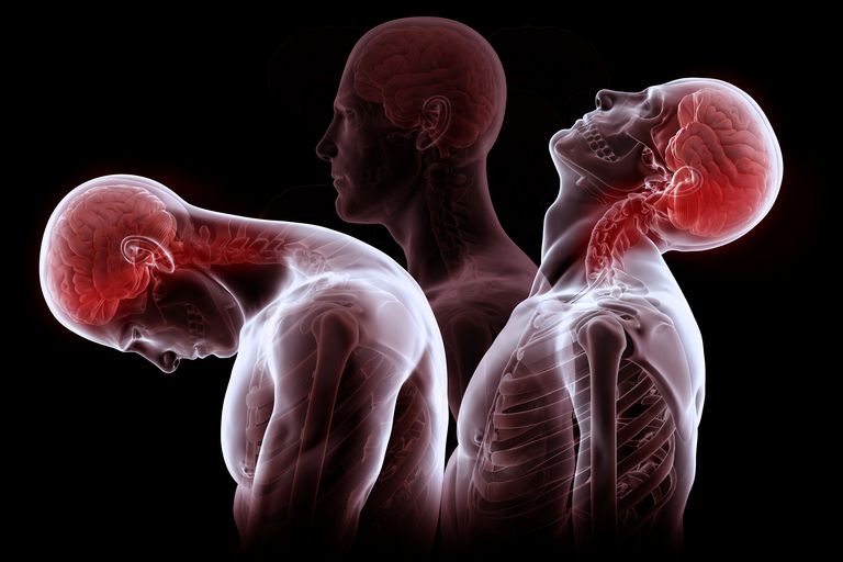 Lesión del cuello: una lista de los tipos más comunes