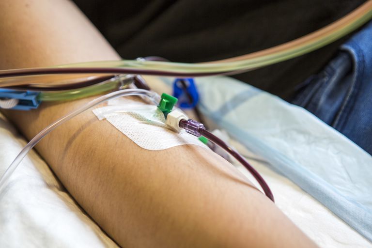 Cáncer de células sanguíneas periféricas Donación Riesgos y efectos secundarios