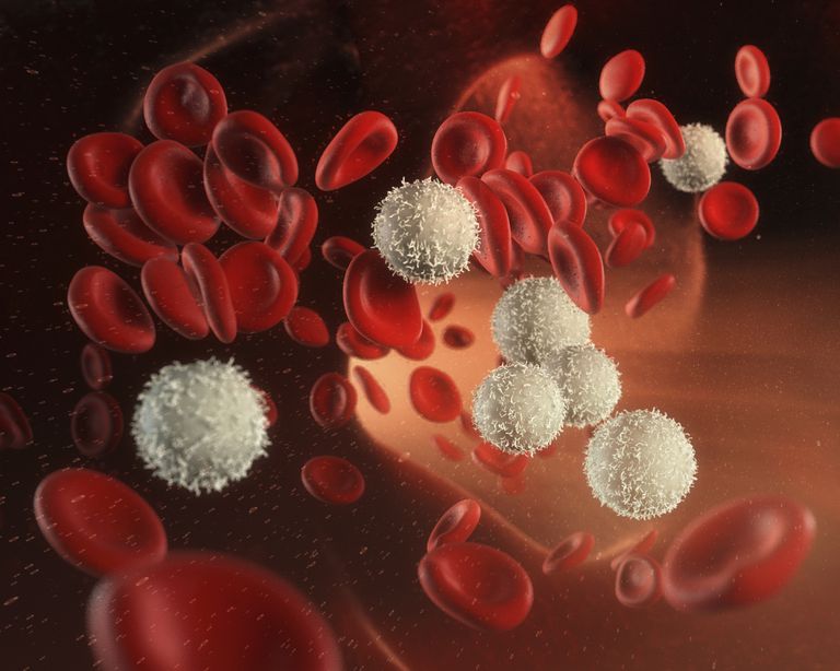 Trasplante de células madre de sangre periférica (PBSCT)