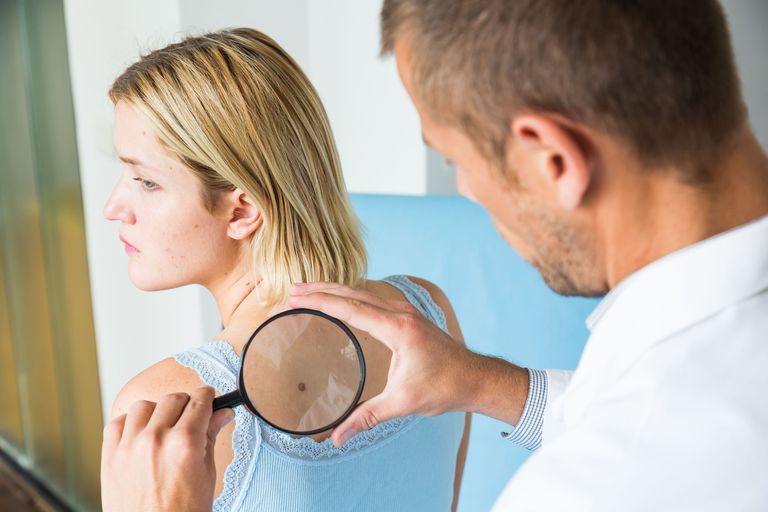 Pros y contras de la disección de los ganglios linfáticos para tratar el melanoma