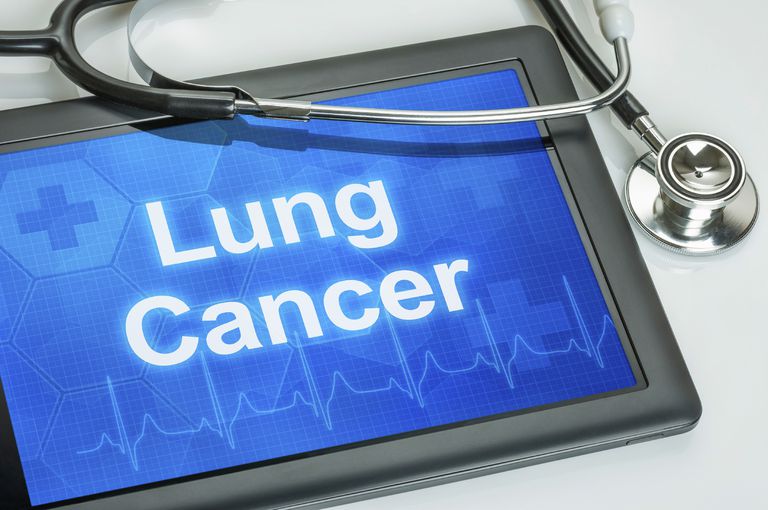 Razones para dejar de fumar no eliminarán las muertes por cáncer de pulmón