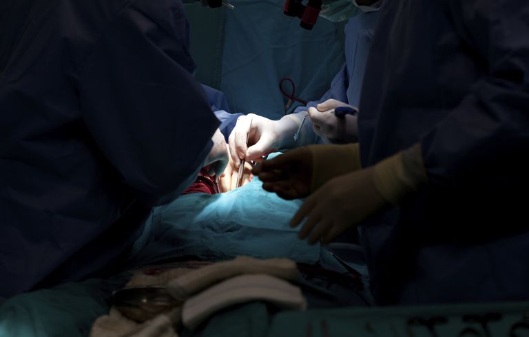 Razones para someterse a cirugía de revascularización coronaria