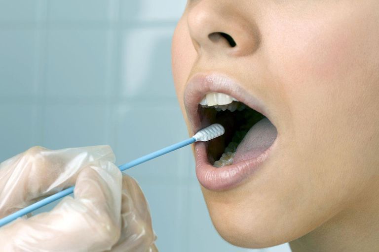 El papel del VPH en la garganta y el cáncer oral
