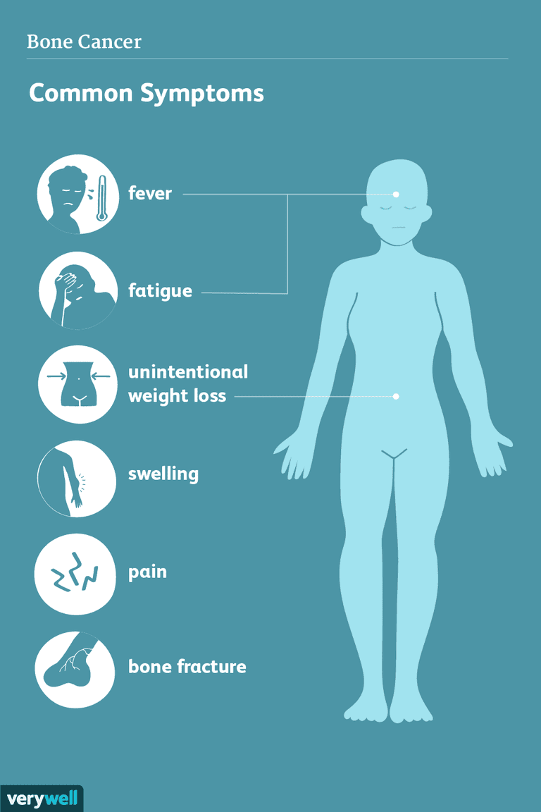 Signos y síntomas del cáncer de hueso
