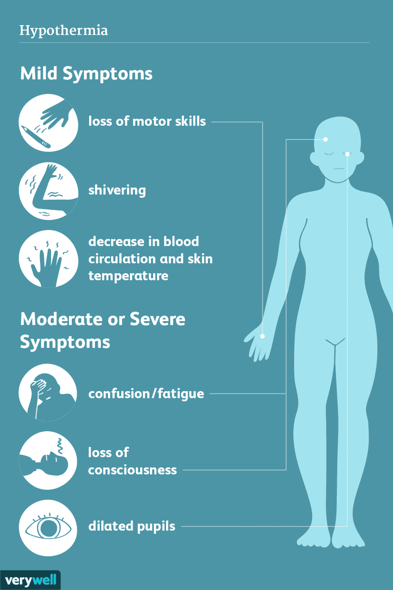 Signos y síntomas de la hipotermia
