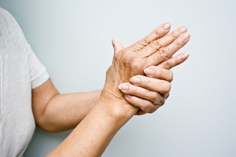 Signos de artritis