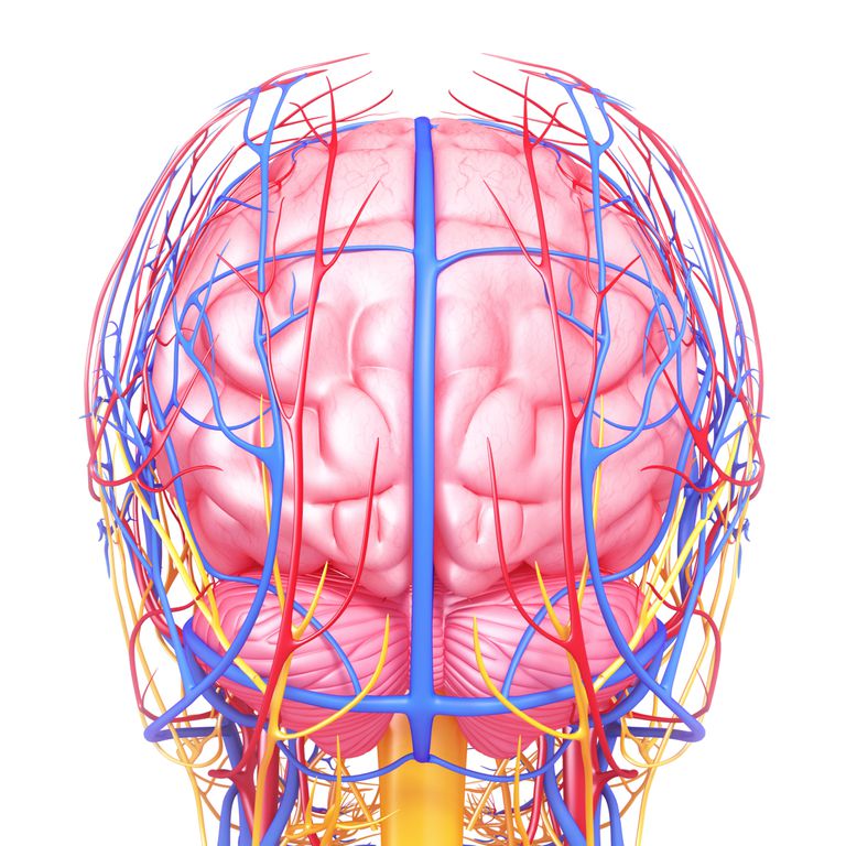 Un hematoma subdural es una hemorragia en el cerebro